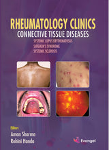 Rheumatology clinics Connective Tissue Diseases