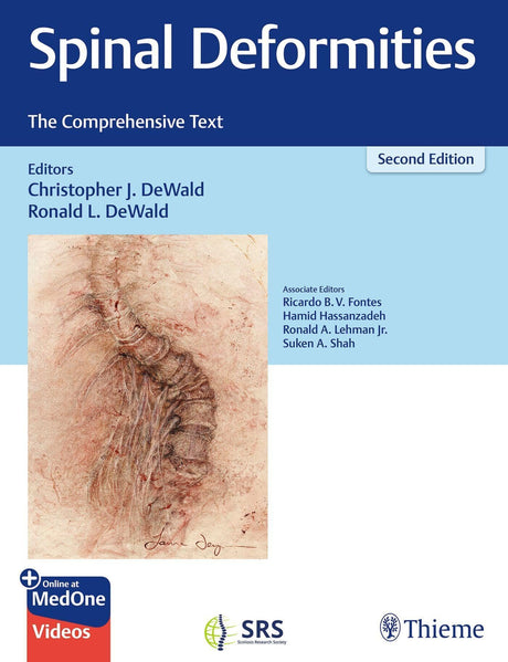 Spinal Deformities: The Comprehensive Text - Retail Maharaj
