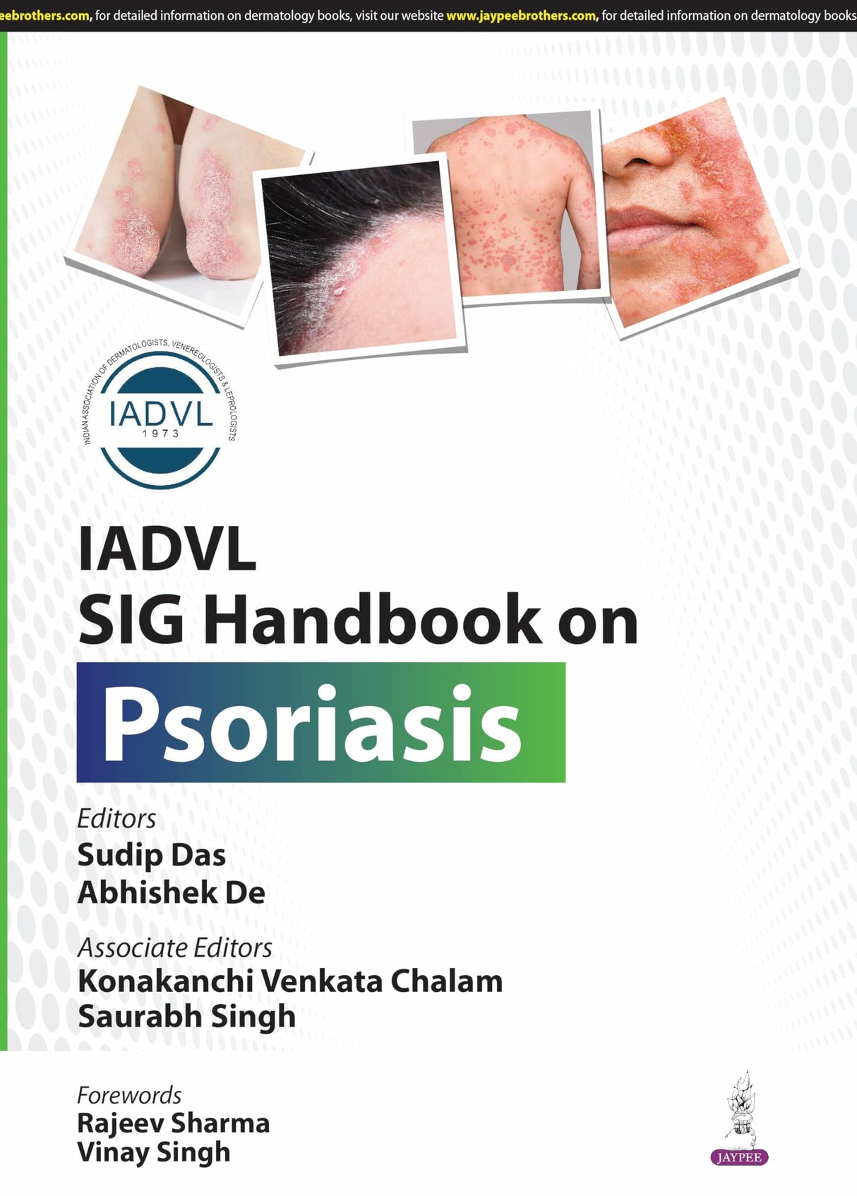 IADVL SIG HANDBOOK ON PSORIASIS