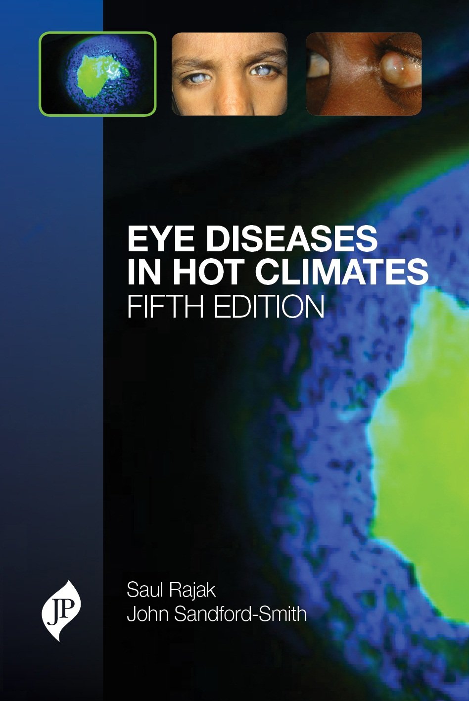 EYE DISEASES IN HOT CLIMATES