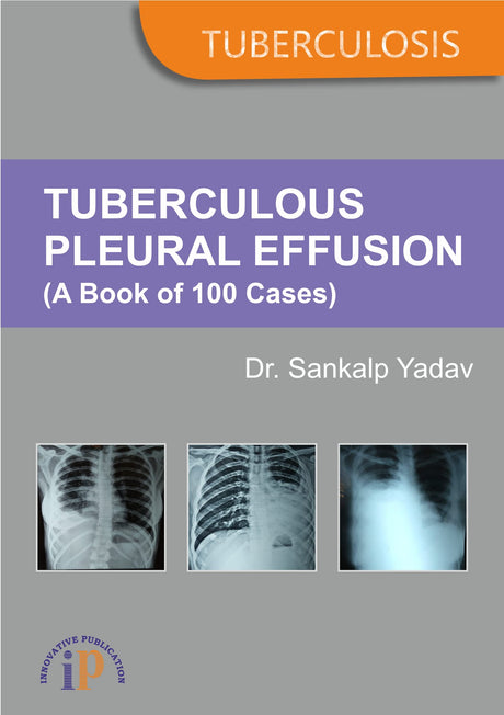 Tuberculous Pleural Effusion (A Book of 100 Cases) - Retail Maharaj