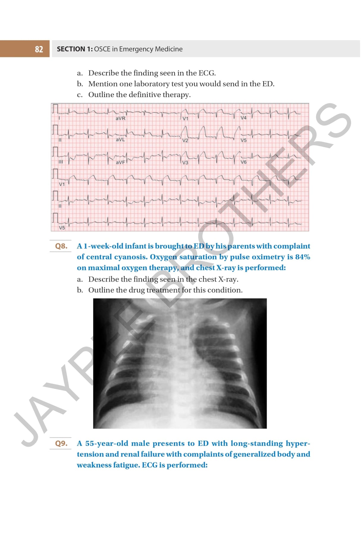 OSCE FOR EMERGENCY MEDICINE PRACTICAL EXAM