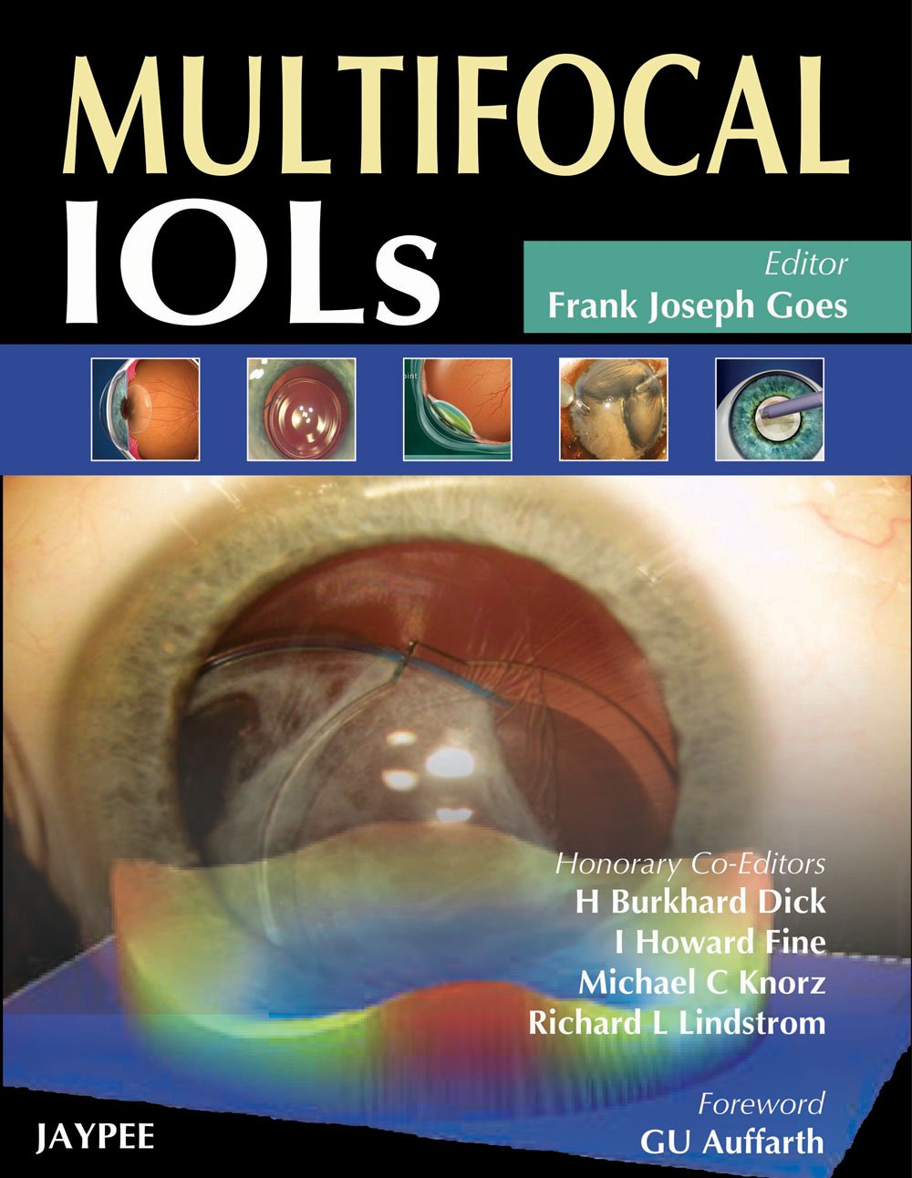 Multifocal IOLs (POD)