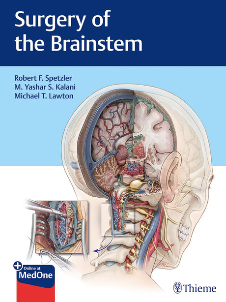 Surgery of the Brainstem 1st Ed. - Retail Maharaj