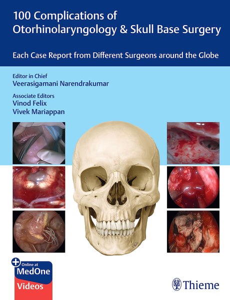 100 Complications of Otorhinolaryngology & Skull Base Surgery: Each Case Report from Different Surgeons Around the Globe - Retail Maharaj