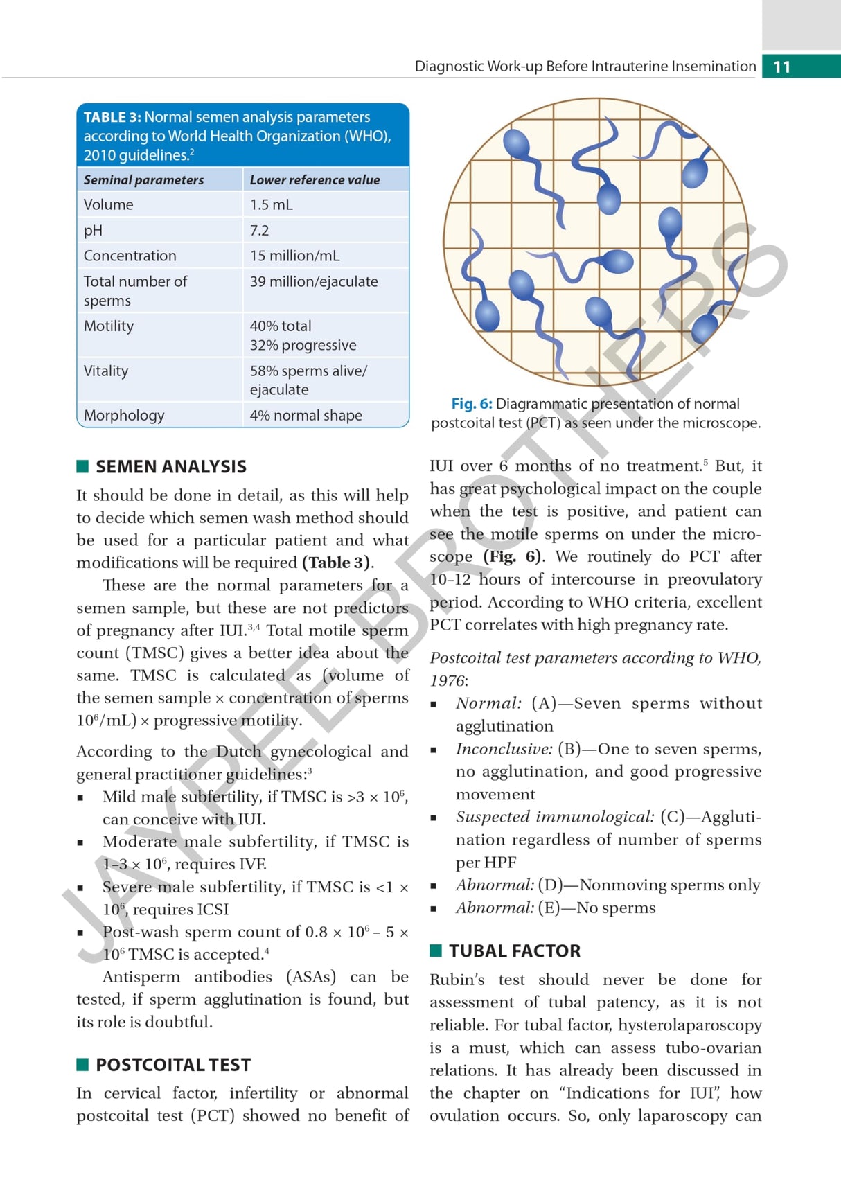 PRACTICAL GUIDE TO INTRAUTERINE INSEMINATION (IUI)