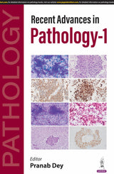 RECENT ADVANCES IN PATHOLOGY-1
