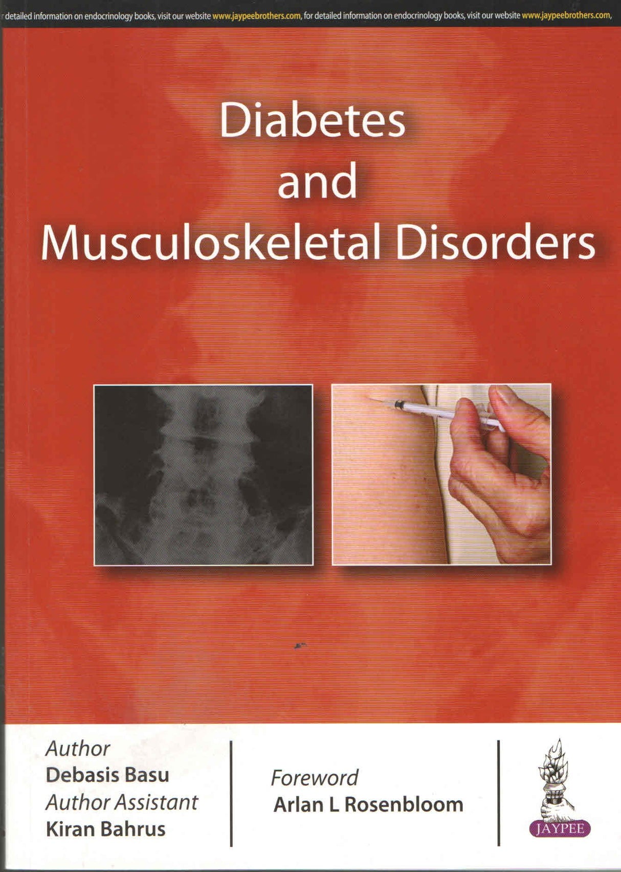 Diabetes and Musculoskeletal Disorders