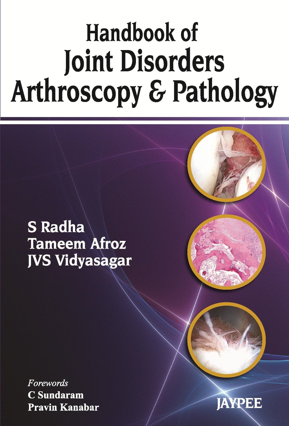 HANDBOOK OF JOINT DISORDERS ARTHROSCOPY & PATHOLOGY