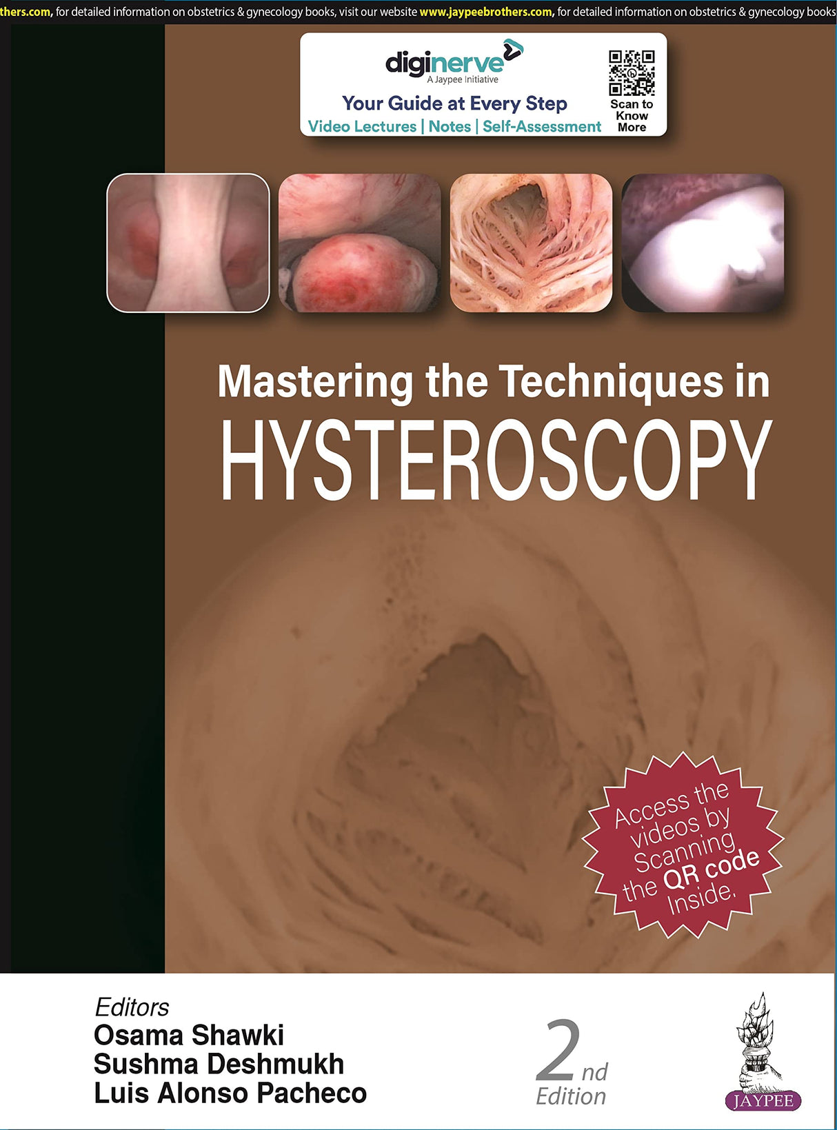 MASTERING THE TECHNIQUES IN HYSTEROSCOPY