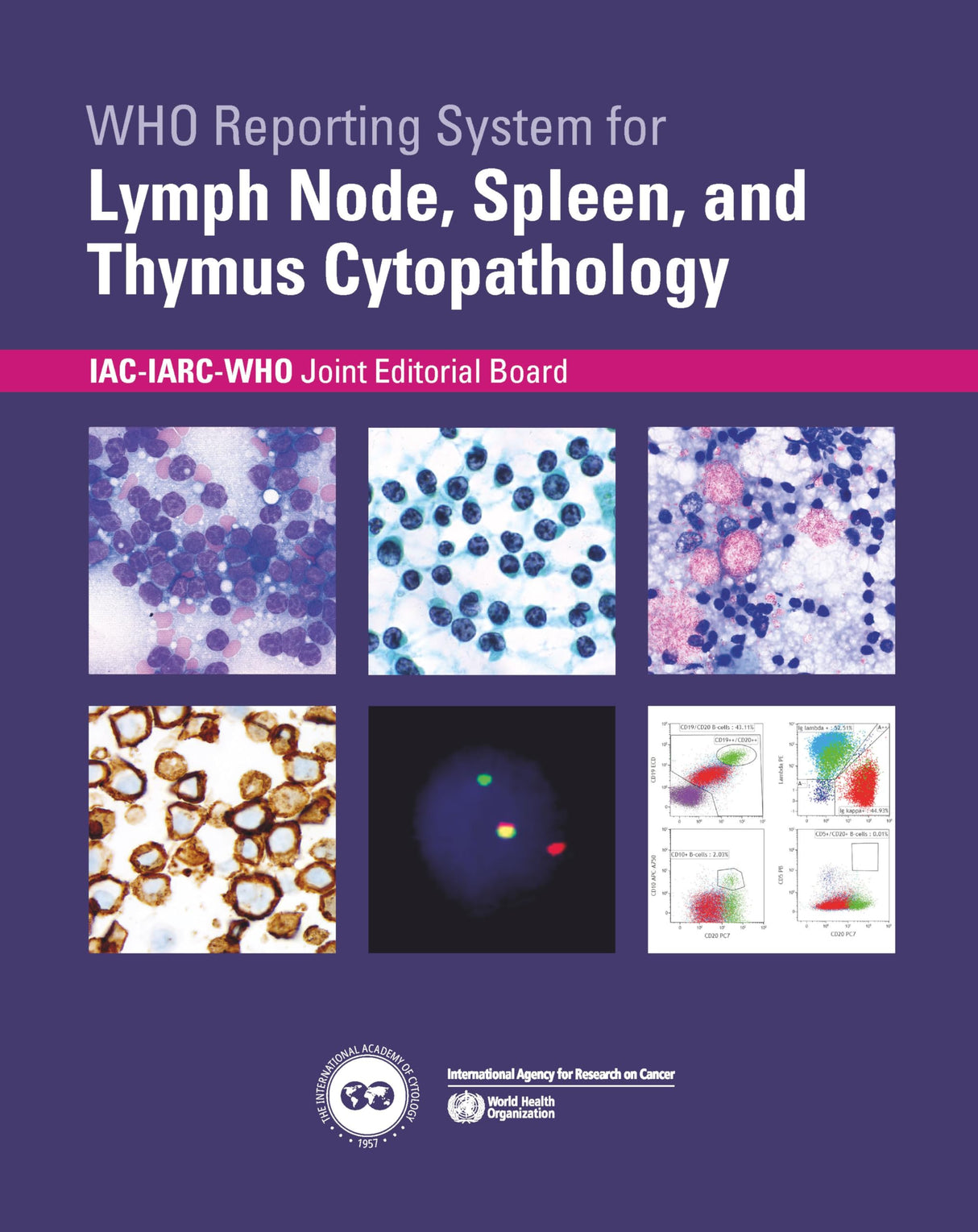 Who Reporting System for Lymph Node, Spleen, and Thymus Cytopathology