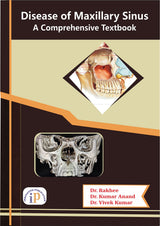Disease of Maxillary Sinus - A Comprehensive Textbook - Retail Maharaj