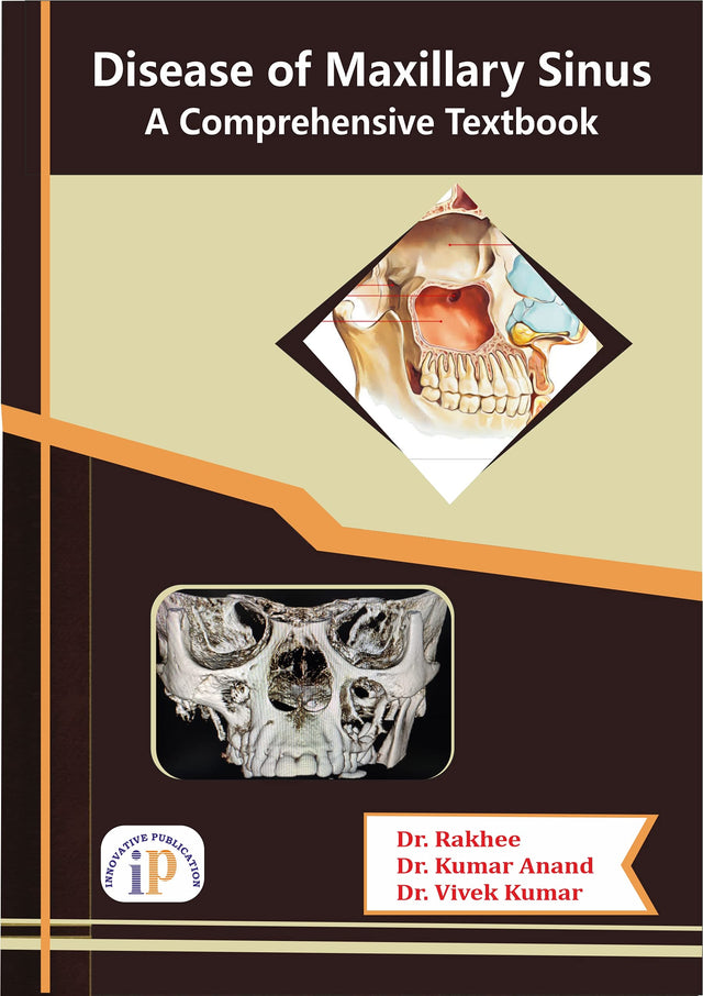 Disease of Maxillary Sinus - A Comprehensive Textbook - Retail Maharaj