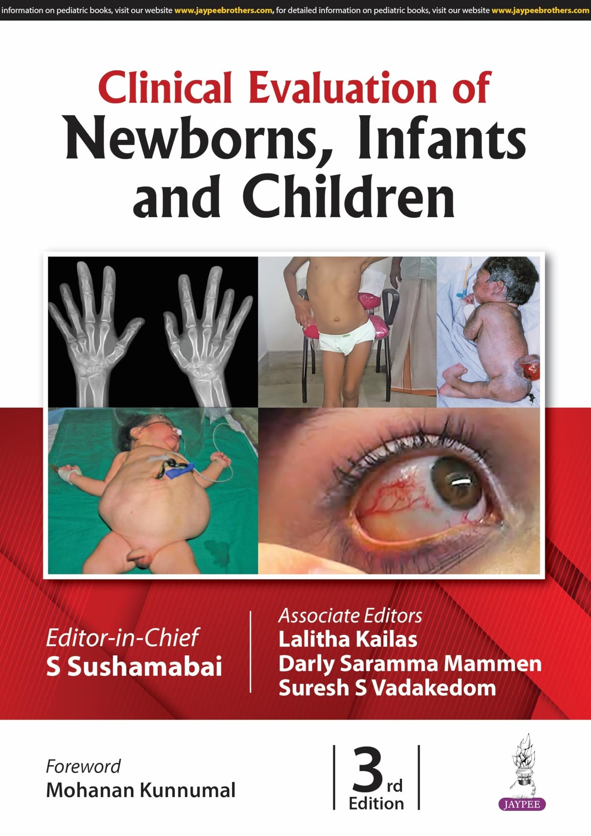 CLINICAL EVALUATION OF NEWBORNS, INFANTS AND CHILDREN