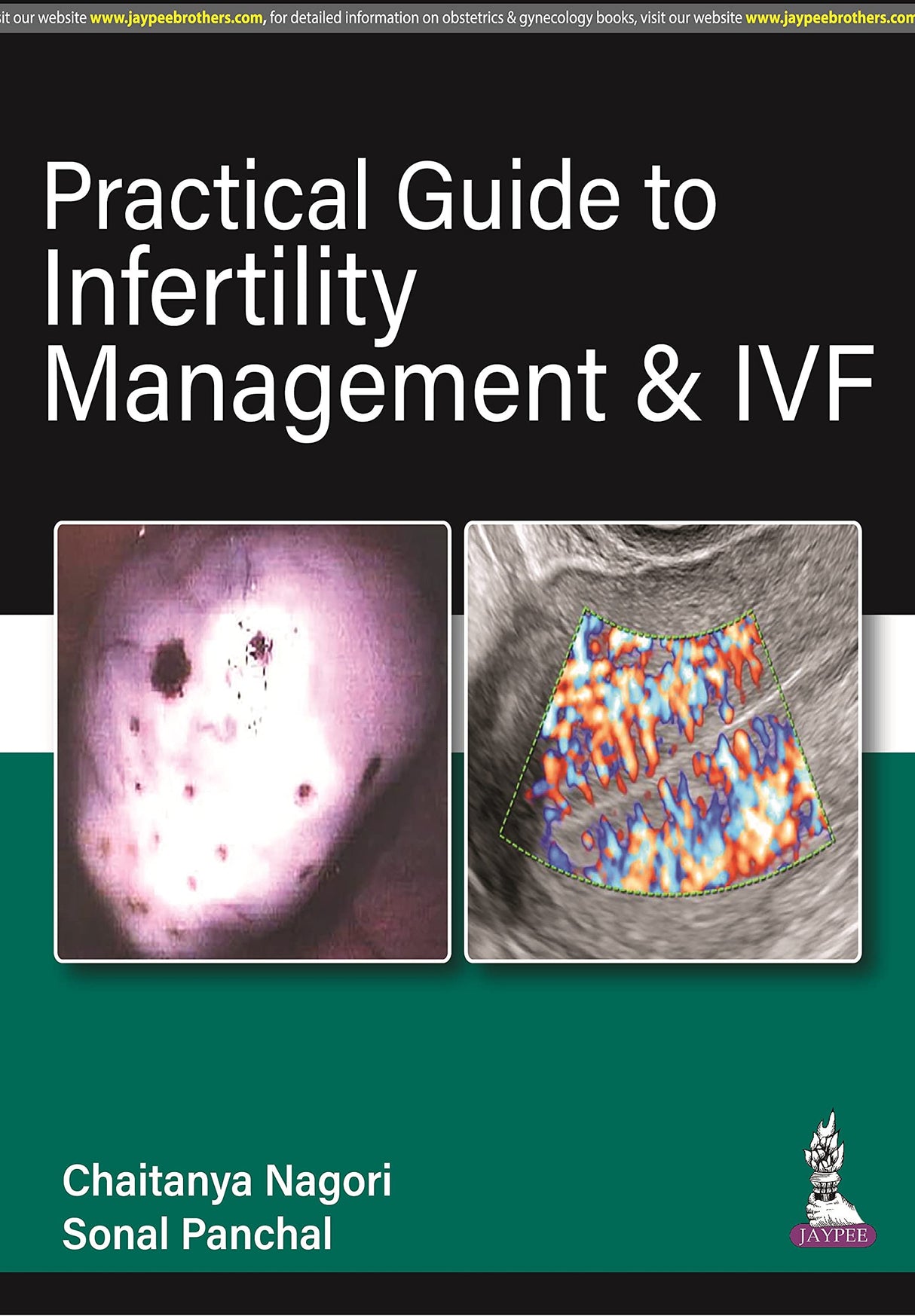 PRACTICAL GUIDE TO INFERTILITY MANAGEMENT & IVF