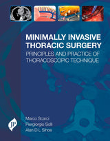 MINIMALLY INVASIVE THORACIC SURGERY PRINCIPLES AND PRACTICE OF THORACOSCOPIC TECHNIQUE