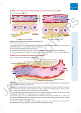 PATHOLOGY SIMPLIFIED: A QUICK REVIEW FOR EXAMINATION PREPARATION