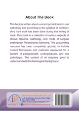 Pleomorphic Adenoma