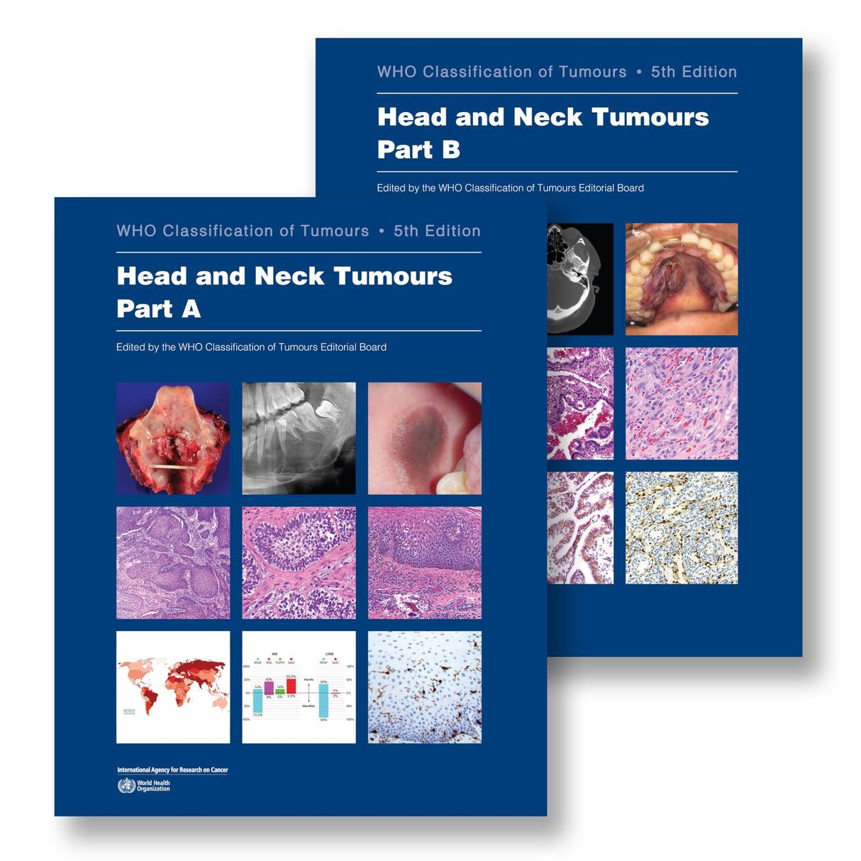 Head and Neck Tumours: Who Classification of Tumours (World Health Organization Classification of Tumours)