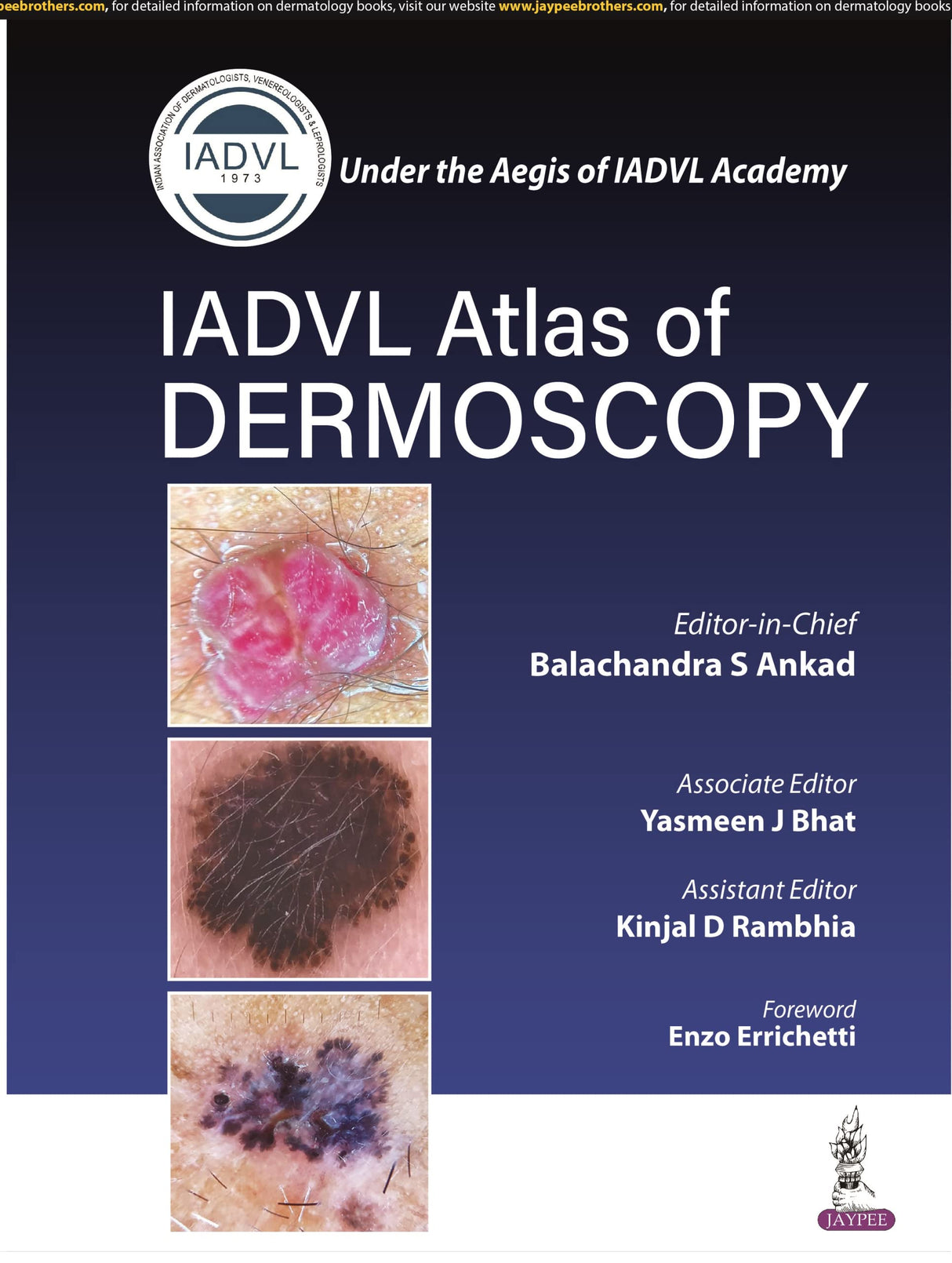 IADVL Atlas of Dermoscopy