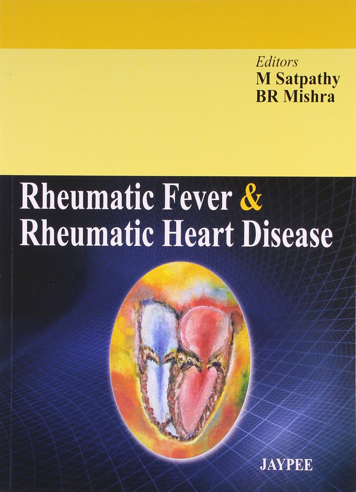 Rheumatic Fever & Rheumatic Heart Disease