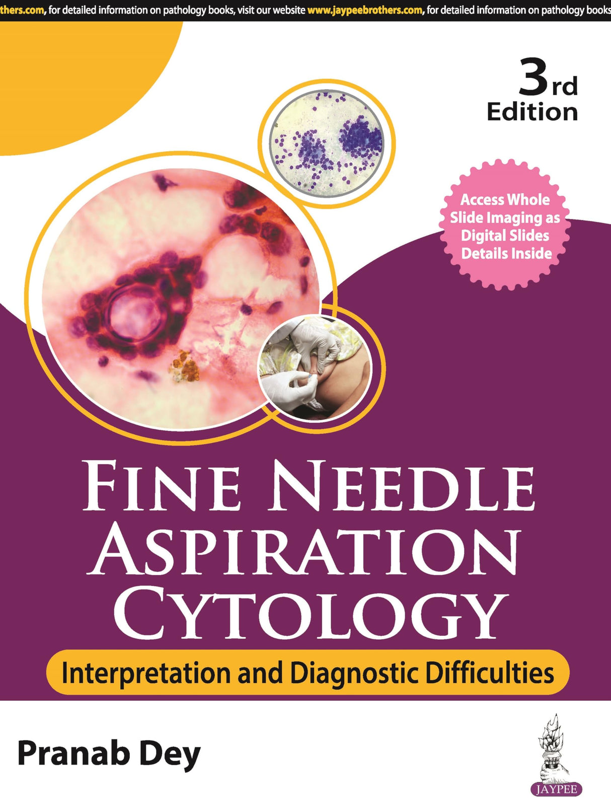 FINE NEEDLE ASPIRATION CYTOLOGY: INTERPRETATION AND DIAGNOSTIC DIFFICULTIES