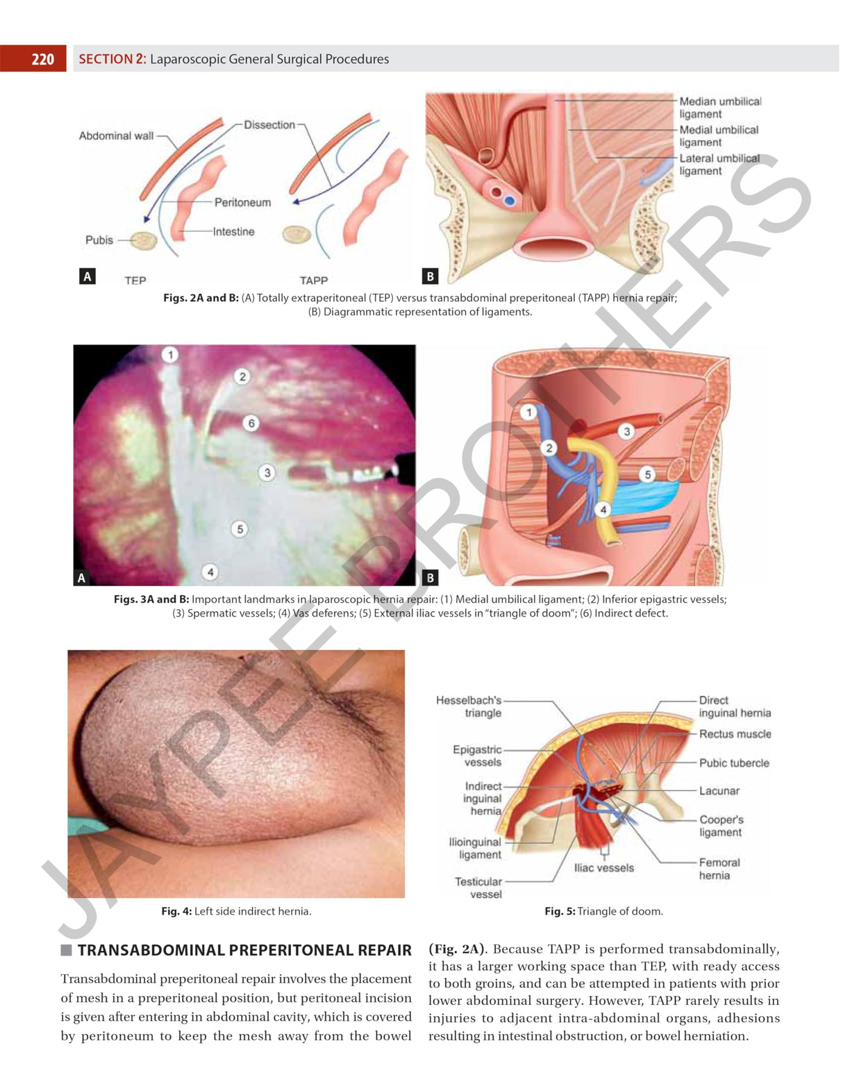 Textbook of Laparoscopy for Surgeons and Gynecologists