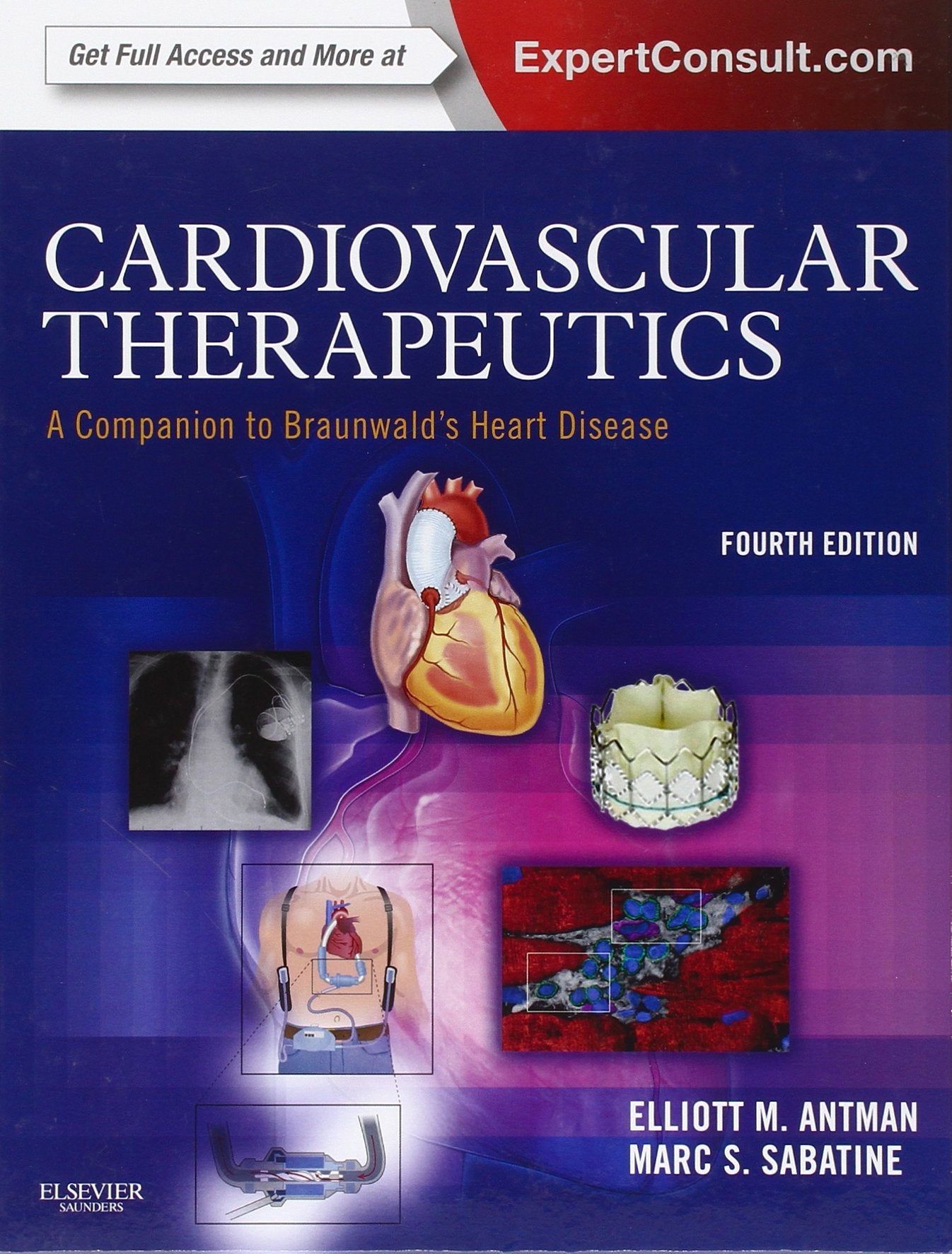 Cardiovascular Therapeutics - A Companion to Braunwald's Heart Disease : Expert Consult - Online and Print