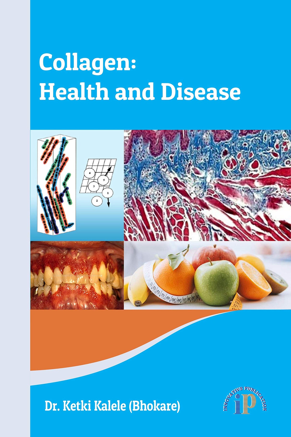 Collagen: Health and Disease