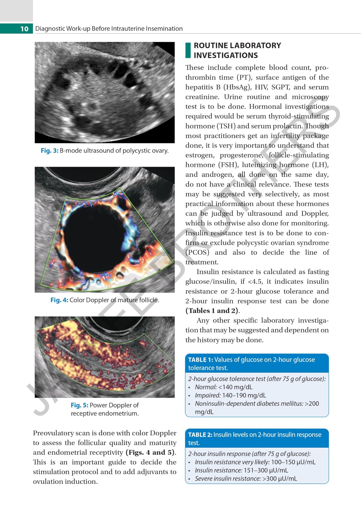 PRACTICAL GUIDE TO INTRAUTERINE INSEMINATION (IUI)