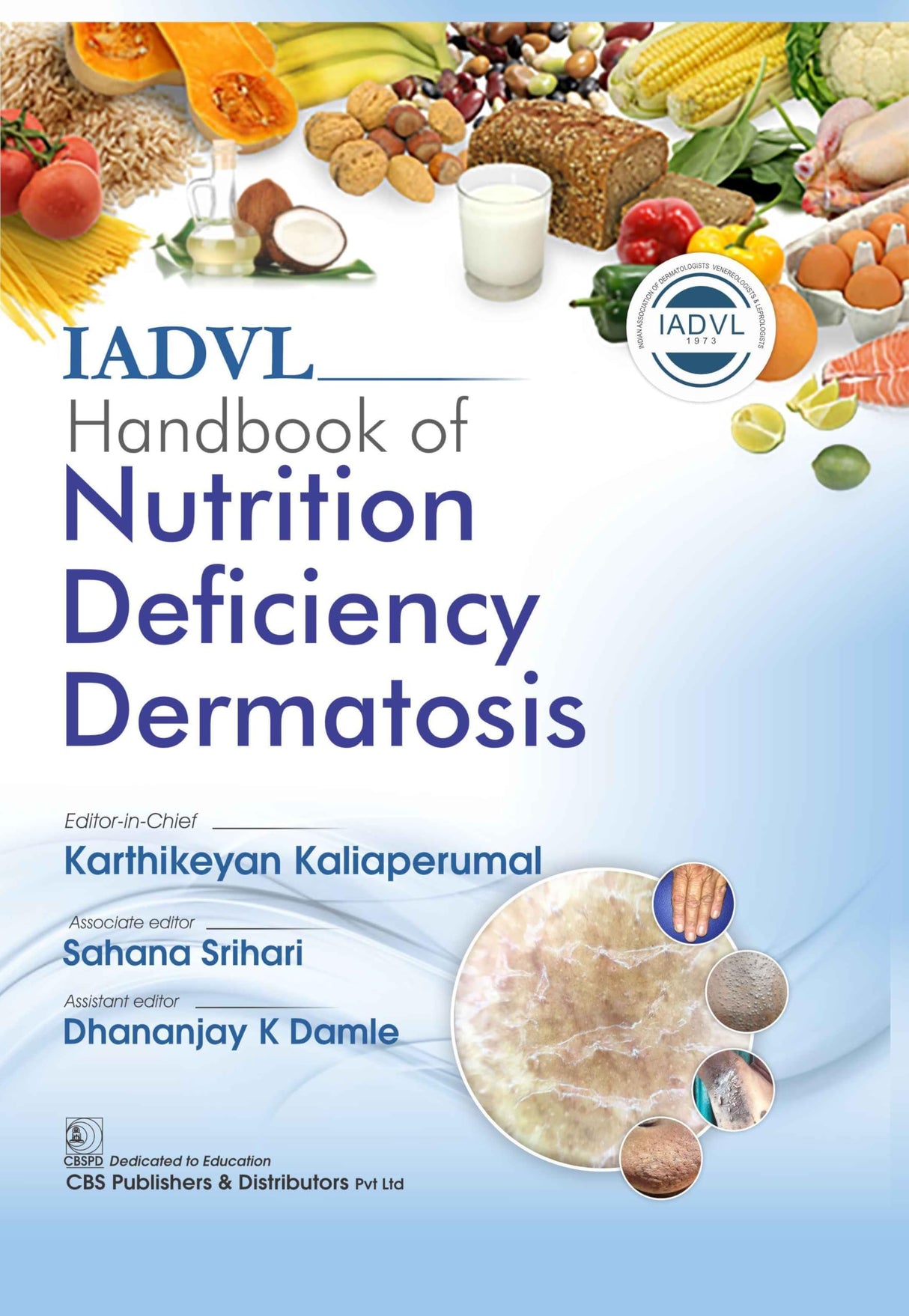 IADVL Handbook Of Nutrition Deficiency Dermatosis