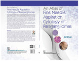 An Atlas of Fine Needle Aspiration Cytology of Paragangliomas