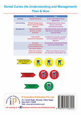 Dental Caries (Its Understanding and Management) Then & Now