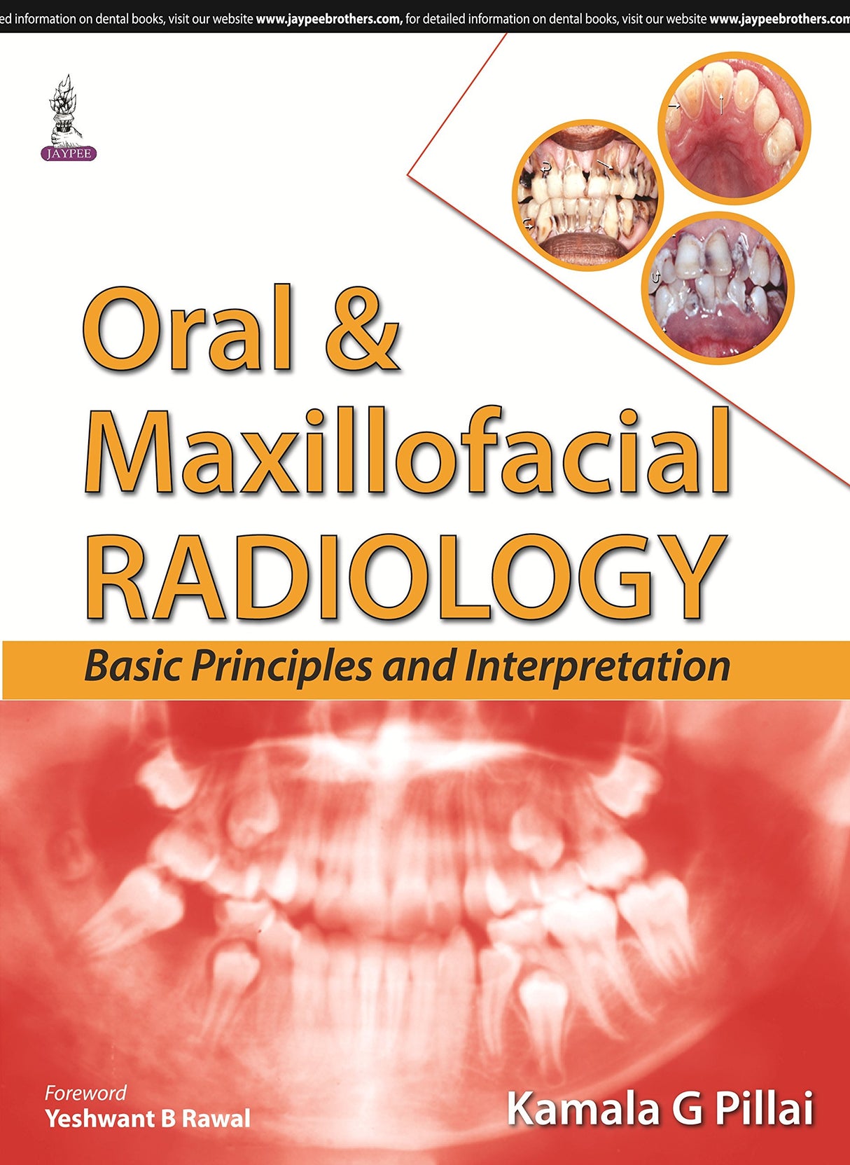 ORAL & MAXILLOFACIAL RADIOLOGY BASIC PRINCIPLES AND INTERPRETATION