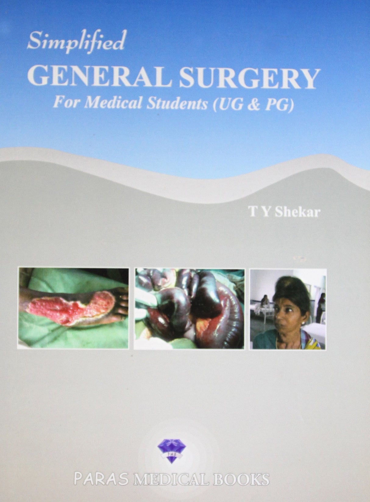 Simplified General Surgery for Medical Students(UG & PG) 1/E