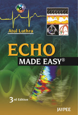 Echo Made Easy With Cd-Rom