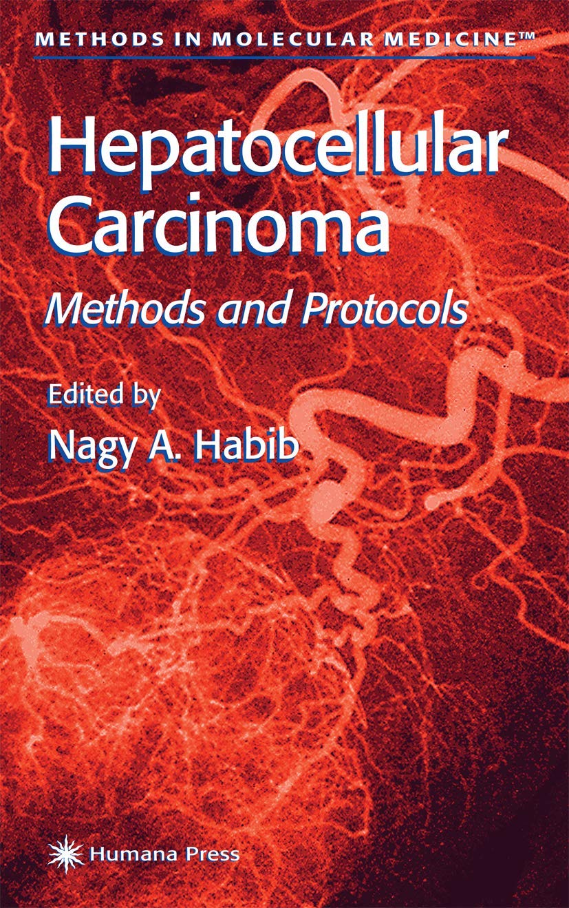 Hepatocellular Carcinoma: Methods and Protocols: 45 (Methods in Molecular Medicine)