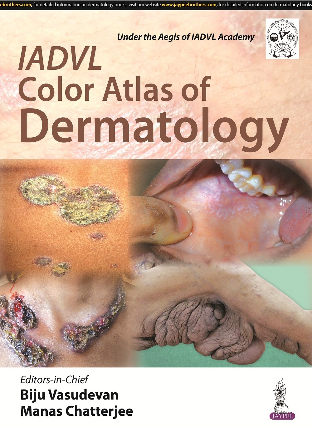 IADVL Color Atlas of Dermatology