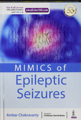 MIMICS OF EPILEPTIC SEIZURES