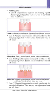 Case History Recording In Periodontology, Divya Bhat - 2nd, 2017.0