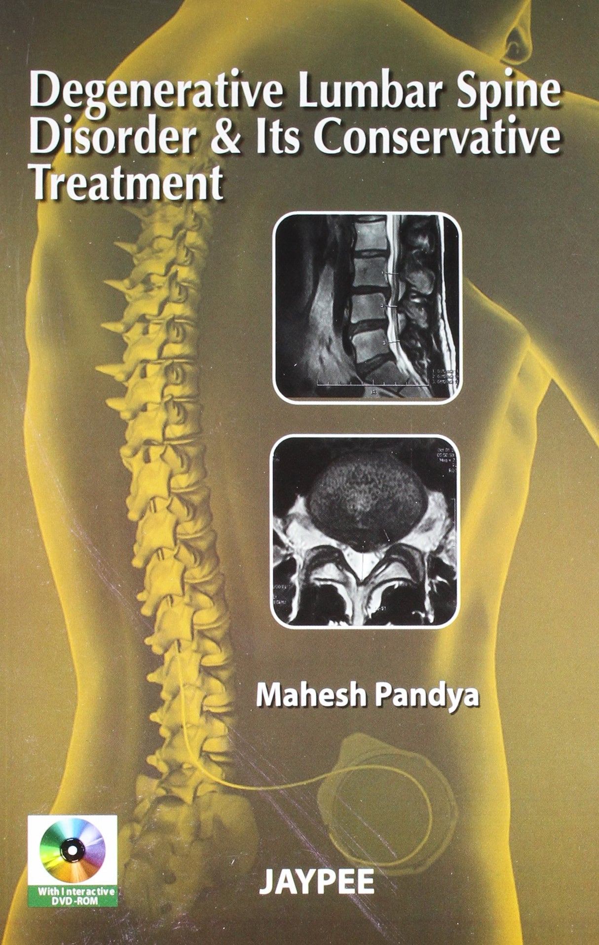 DEGENERATIVE LUMBAR SPINE DISORDER & ITS CONSERVATIVE TREATMENT WITH DVD-ROM - Retail Maharaj