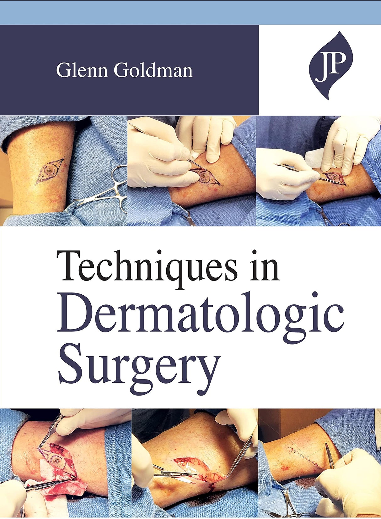 TECHNIQUES IN DERMATOLOGIC SURGERY