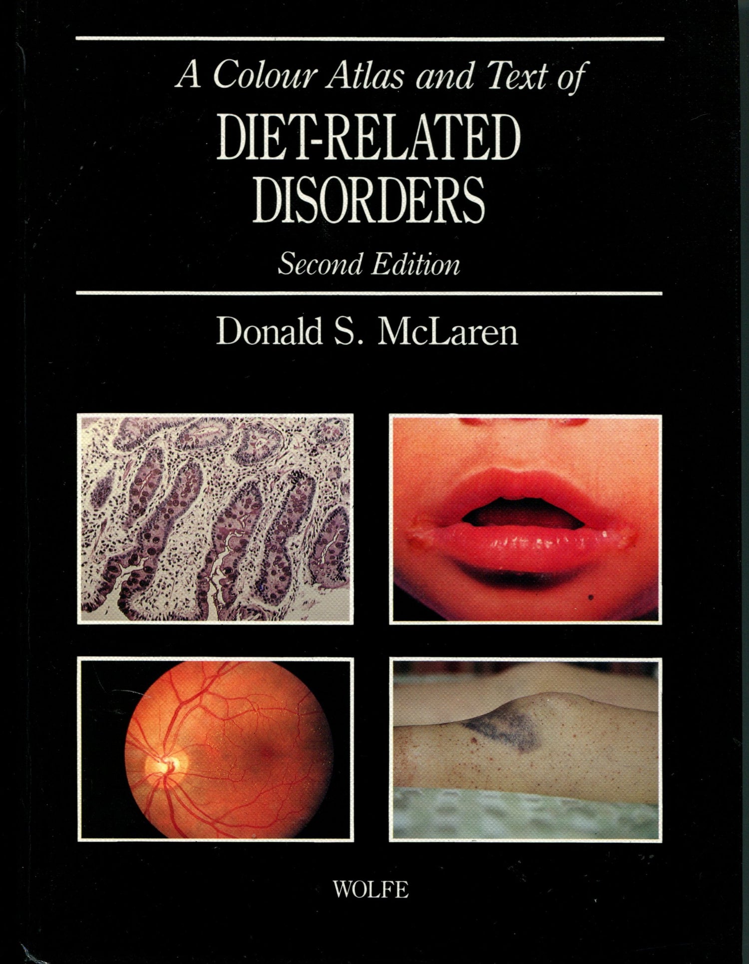 A Colour Atlas and Text of Diet-related Disorders