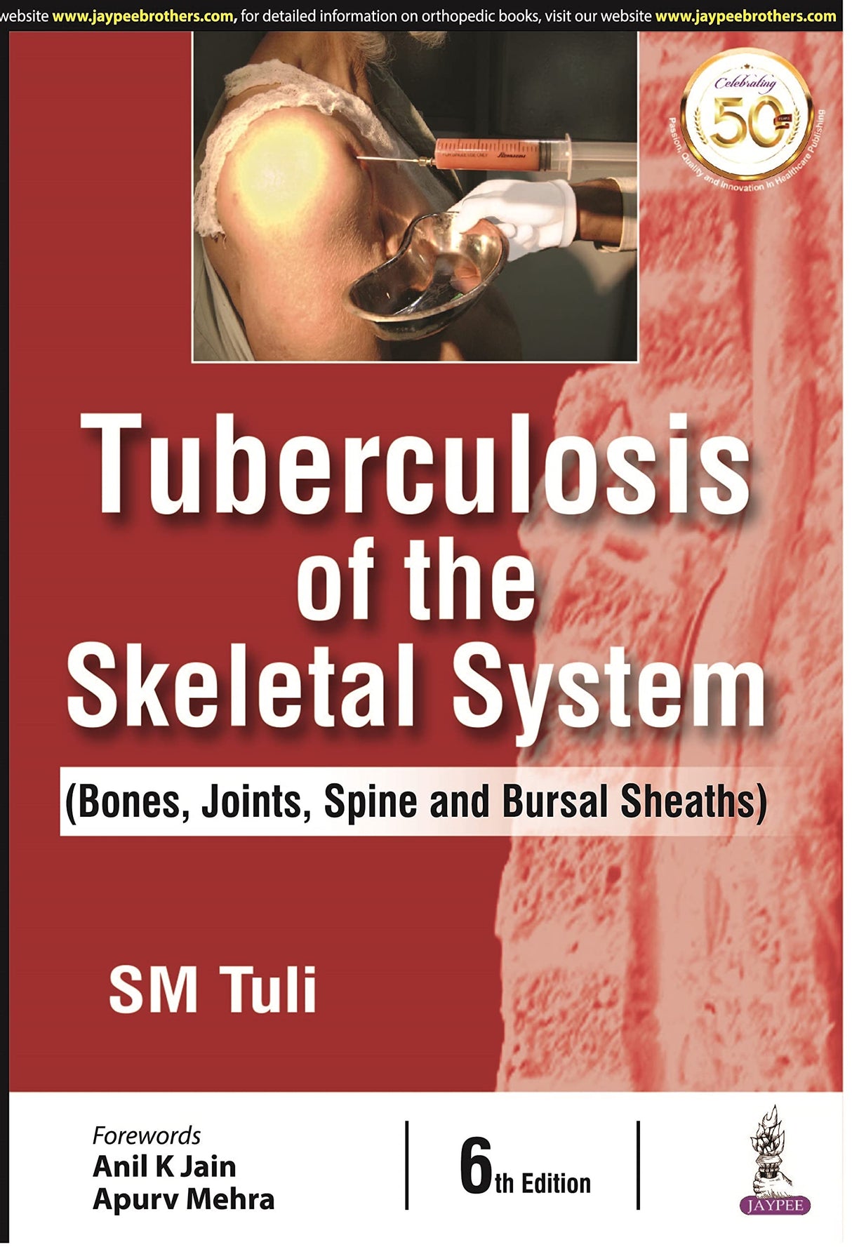Tuberculosis of the Skeletal System (Bones, Joints, Spine and Bursal Sheaths)