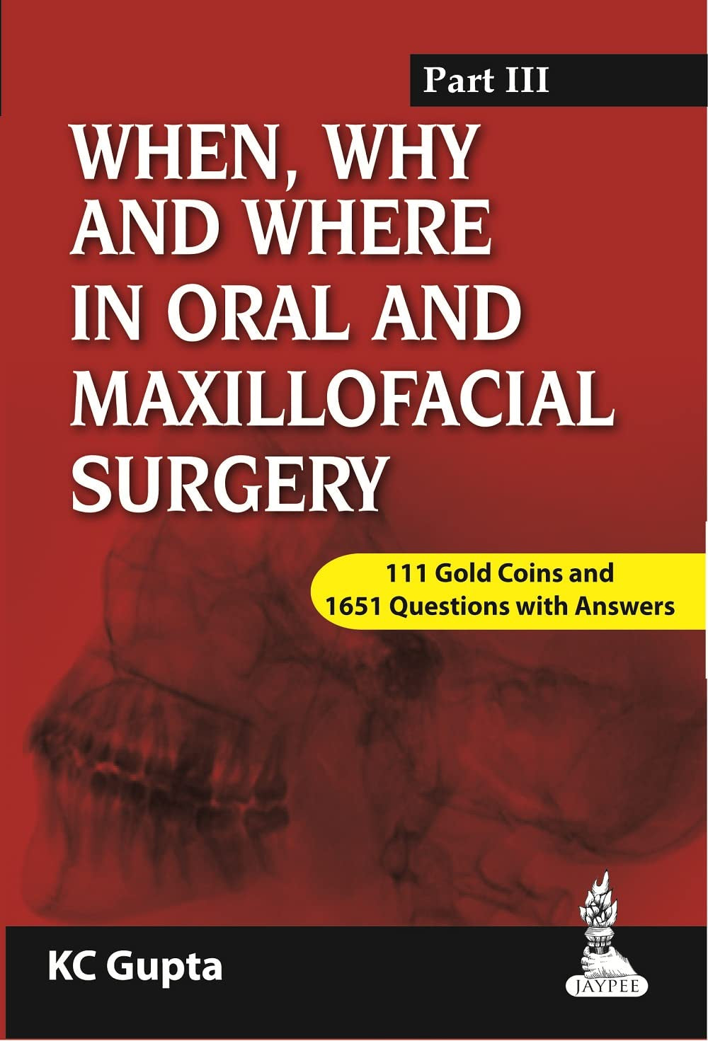 WHEN,WHY AND WHERE IN ORAL AND MAXILLOFACIAL SURGERY PART III