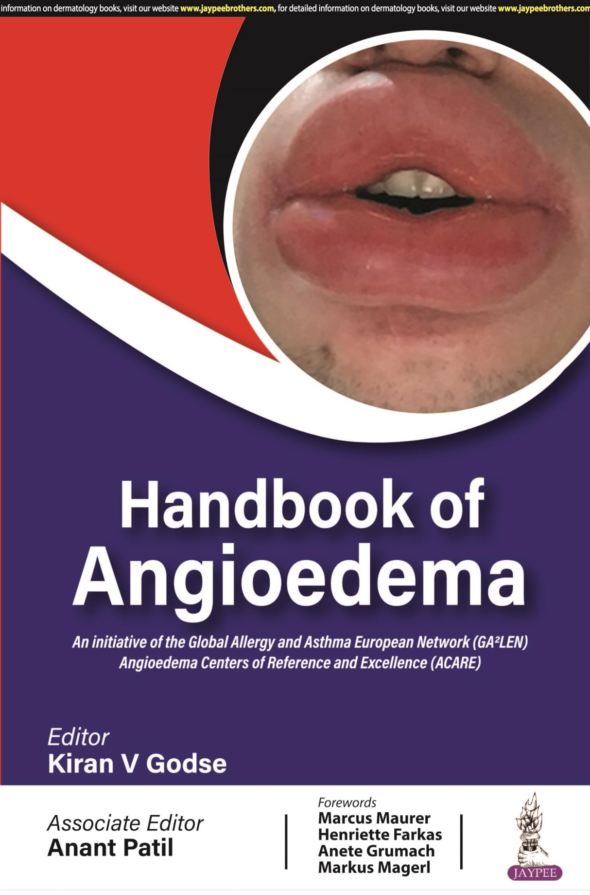 Handbook of Angioedema