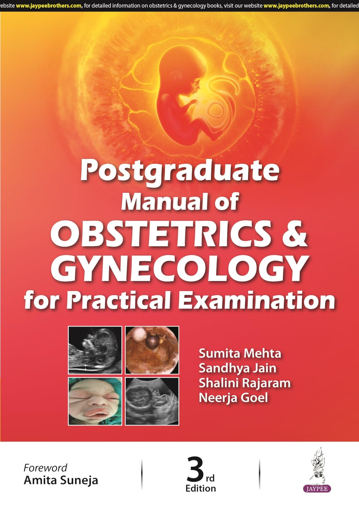 POSTGRADUATE MANUAL OF OBSTETRICS & GYNECOLOGY FOR PRACTICAL EXAMINATION - Retail Maharaj