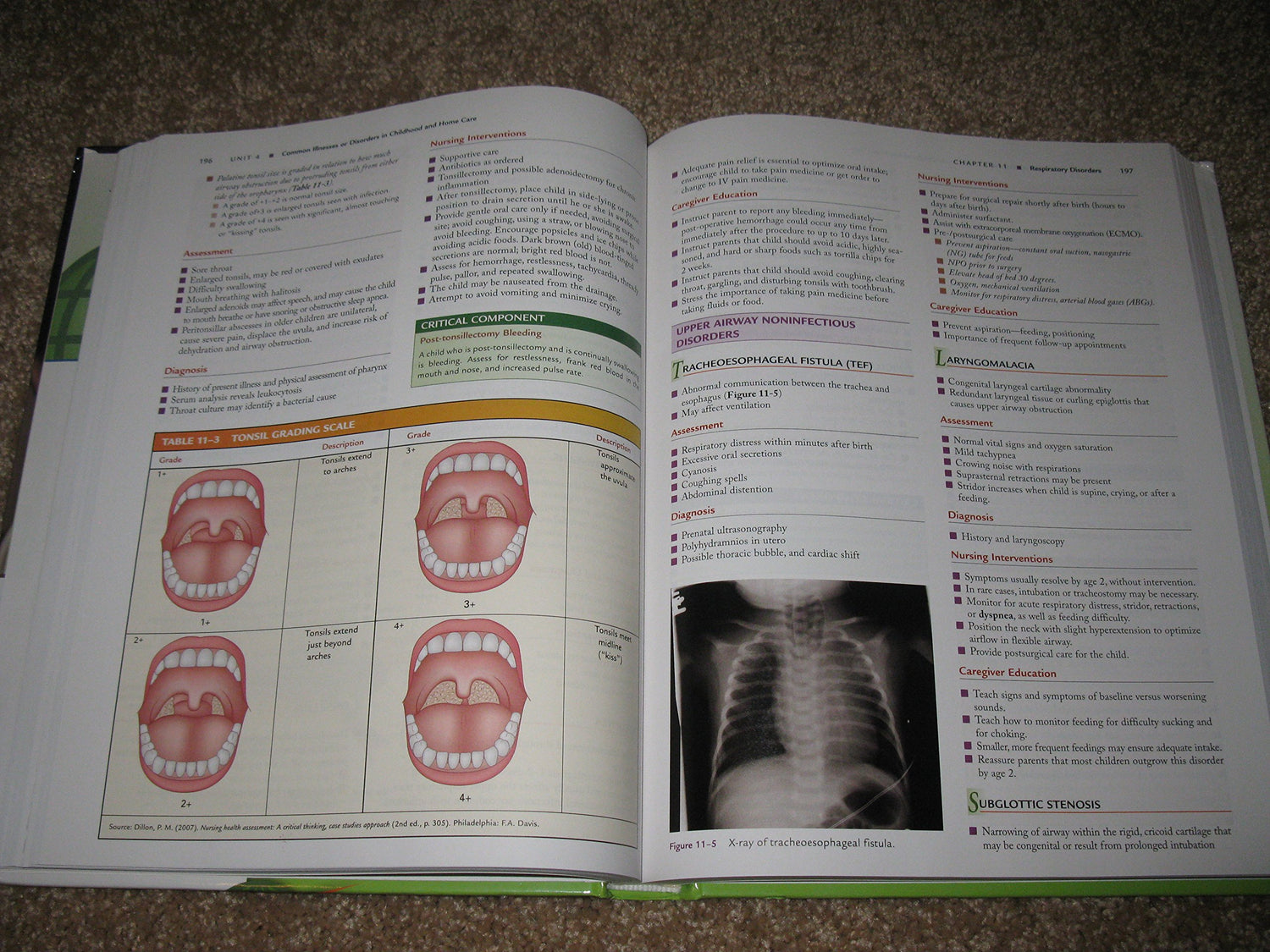 (OLD)PEDIATRIC NURSING THE CRITICAL COMPONENTS OF NURSING CARE PLUS CODE INSIDE