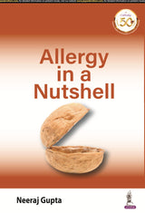 Allergy in a Nutshell: A Handbook