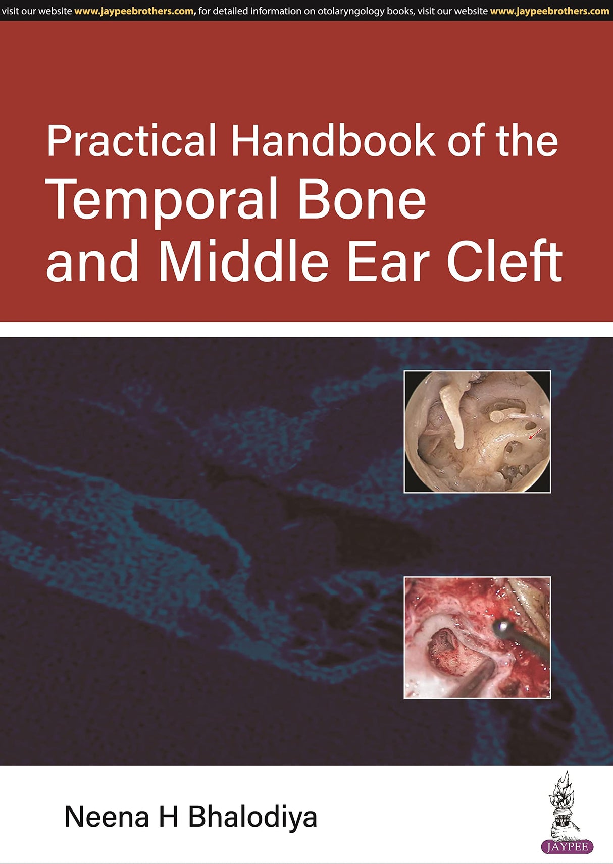 PRACTICAL HANDBOOK OF THE TEMPORAL BONE AND MIDDLE EAR CLEFT